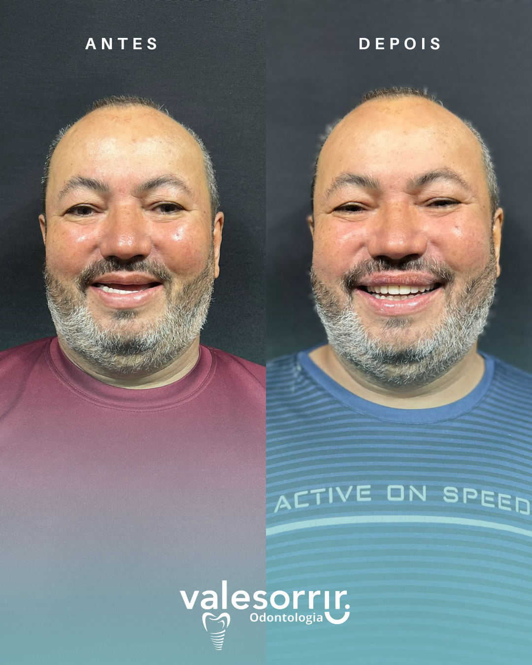 Antes e depois - dona Licia.zip - 1